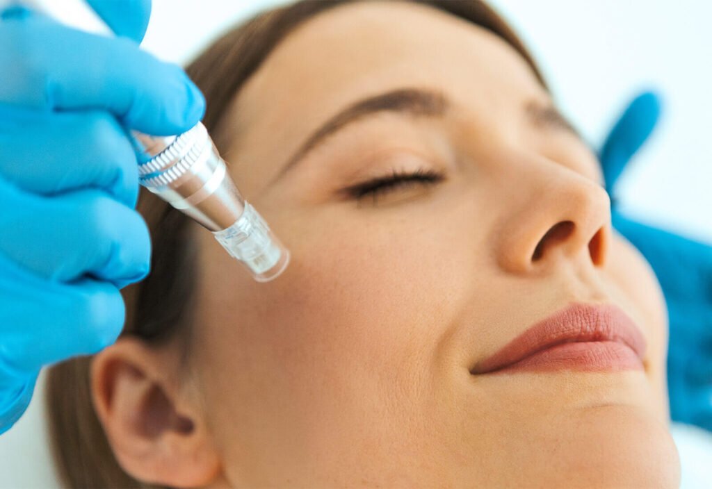 Medicina estética facial en Villalba, Mesoterapia Facial en Villalba